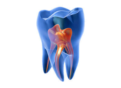 Лечение зубов под седацией нижний новгород