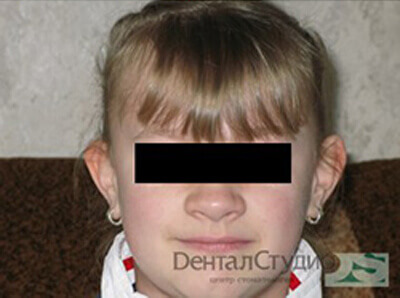 Modified Image