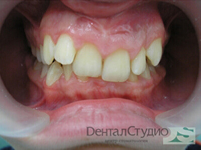 Лечение зубов под седацией нижний новгород thumbnail