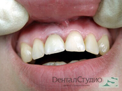 Лечение зубов с седацией в нижнем новгороде thumbnail