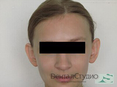 Modified Image